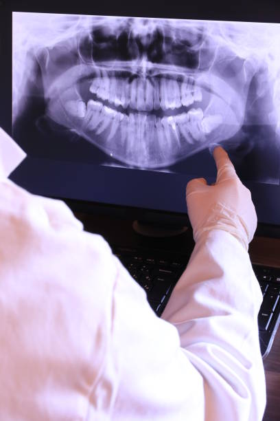 Best Dentist for Tooth Abscess  in Butner, NC