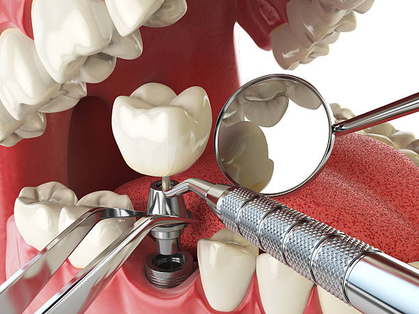 Best Broken Tooth Emergency  in Butner, NC